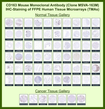 CD163 Antibody for IHC Tissue Microarray (TMA). Immunohistochemistry analysis of CD163 (Cluster of Differentiation 163) expression across formalin-fixed, paraffin-embedded human tissue microarrays using CD163 Immunohistochemistry Antibody clone MSVA-163M. The array contains a broad range of normal and cancer tissues, showing strong membranous and cytoplasmic HRP-DAB brown staining in macrophage populations, with prominent labeling in spleen, liver, lung, and lymphoid tissues, while most non-hematopoietic parenchymal cells remain negative. In cancer tissue arrays, CD163-positive tumor-associated macrophages are variably enriched within tumor stroma and at invasive margins, highlighting macrophage infiltration patterns consistent with tumor microenvironment remodeling and immunosuppressive signaling. The staining profile aligns with known CD163 expression patterns and Human Protein Atlas data.