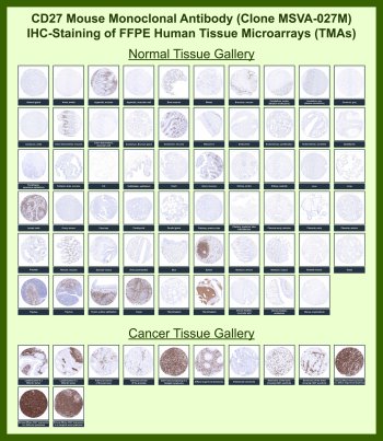CD27 Antibody for IHC Tissue Microarray (TMA). Immunohistochemistry analysis of CD27 molecule CD27, also known as TNFRSF7, in formalin-fixed paraffin-embedded human normal and cancer tissue microarrays using recombinant mouse monoclonal CD27 antibody clone MSVA-027M. Tissue microarray (TMA) staining with HRP-DAB brown chromogen demonstrates strong membranous localization in lymphocyte-rich tissues including tonsil, lymph node, spleen, and thymus, highlighting activated and memory T and B lymphocyte populations, while most non-lymphoid tissues remain largely negative. Within tumor tissue microarrays, CD27-positive tumor-infiltrating lymphocytes are detected across multiple malignancies, with strong and diffuse staining observed in lymphoid neoplasms consistent with B cell lineage origin. Evaluation across large TMA panels enables direct comparison of CD27 expression across diverse tissue types under standardized conditions. The observed staining patterns align with reported CD27 expression profiles in the Human Protein Atlas, supporting its use as a lymphocyte marker and indicator of the immune microenvironment.