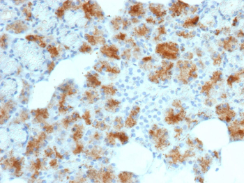 Immunohistochemistry of Folate receptor alpha in human adrenal gland tissue. Formalin-fixed, paraffin-embedded human adrenal gland tissue stained with recombinant Folate receptor 1 antibody (clone FOLR1/12903R) shows cytoplasmic punctate staining in adrenal cortical cells, with minimal signal in surrounding stromal regions. Inset shows negative control with PBS substituted for the primary antibody. Antigen retrieval was performed by heating tissue sections in 10 mM Tris with 1 mM EDTA, pH 9.0, at 95oC for 45 minutes, followed by cooling at room temperature for 20 minutes.