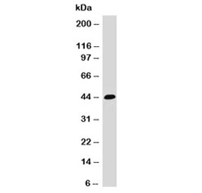 Western blot testing of HCT116 cell lysate and EpCAM antibody (EPM17-1). Expected molecular weight: ~35 kDa (unmodified), 40-43 kDa (glycosylated).