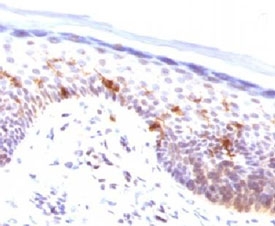 CD1A Antibody for IHC. Immunohistochemistry analysis of CD1A / CD1a expression in FFPE human skin tissue using CD1A Antibody (clone CLDA1a). Membranous and cytoplasmic staining is observed in dendritic cells within the epidermis, consistent with Langerhans cell localization, while surrounding keratinocytes remain largely negative. The presence of CD1a-positive cells along the epithelial layer reflects immune surveillance at barrier surfaces and supports evaluation of dendritic cells involved in mucosal and epithelial immune defense. Staining of formalin-fixed tissues requires boiling tissue sections in pH 9 10 mM Tris with 1 mM EDTA for 10-20 minutes followed by cooling at RT for 20 minutes.