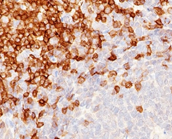 CD5 Antibody for IHC. Immunohistochemistry analysis of CD5 antibody staining in FFPE human tonsil tissue using an inflammatory response regulation marker antibody, clone CLDA5-1. Strong membranous staining is observed in interfollicular T lymphocytes with dense labeling of T cell zones surrounding germinal centers, while follicular B cell regions remain largely negative. The staining pattern highlights normal tonsillar architecture and reflects the role of CD5 in regulating immune activation and inflammatory signaling within lymphoid tissue. Heat-induced epitope retrieval was performed using pH 9 Tris-EDTA buffer for 10-20 minutes followed by cooling at room temperature prior to antibody incubation.
