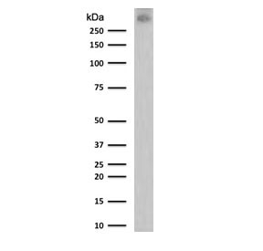 Western blot testing of human T47D cell lysate with MUC-1 antibody (clone MCN01-1). Expected molecular weight: 120-500 kDa depending on glycosylation level.