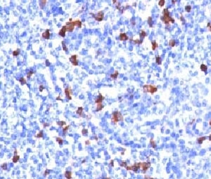 Human IgG Antibody GHC07-1 Tonsil IHC. Immunohistochemistry testing of human tonsil and IgG antibody (clone GHC07-1). Required HIER: boil tissue sections in 10mM citrate buffer, pH 6, for 10-20 min followed by cooling at RT for 20 min.