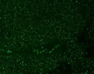 Immunofluorescent staining of AF488 conjugated Nucleoli Marker antibody and FFPE human colon carcinoma. HIER: boil tissue sections in pH6, 10mM citrate buffer, for 10-20 min and allow to cool before testing.
