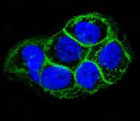Immunofluorescent testing of A431 cells and Alexa Fluor conjugated EGFR antibody (green, clone ERB59-1) with DAPI nuclear stain (blue).