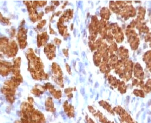 Calponin Antibody Rat Uterus Immunohistochemistry. IHC testing of FFPE rat uterus and Calponin antibody (clone CLPN5-1). Staining of formalin-fixed tissues requires boiling tissue sections in 10mM Tris with 1mM EDTA, pH 9, for 10-20 min followed by cooling at RT for 20 min.