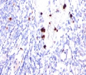 G-CSF Antibody Human Tonsil Tissue IHC. Immunohistochemistry staining of FFPE human tonsil and G-CSF antibody (PRPN2-1). Note cytoplasmic staining of granulocytes.