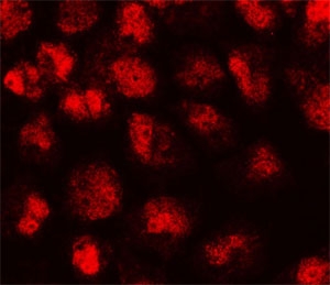 Immunofluorescent staining of human HeLa cells with p21 antibody (clone WAF21-1).