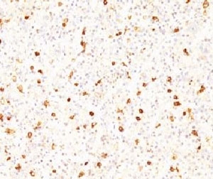IHC testing of FFPE human pituitary with LHB antibody (clone CCGD1).