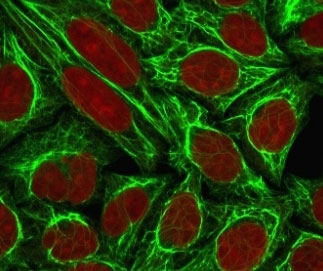 Immunofluorescence analysis of Cytokeratin 18 / CK18 antibody (clone CTKN18-1) in human MCF7 cells. Permeabilized human MCF7 cells were stained using Cytokeratin 18 antibody (clone CTKN18-1, green) to visualize the cytoplasmic intermediate filament network, with nuclear counterstaining performed using Reddot (red). Cytokeratin 18 signal is observed as an extensive filamentous cytoplasmic network surrounding the nuclei, while nuclear staining is confined to the nuclear compartment. This staining pattern reflects cytoplasmic localization of Cytokeratin 18 in epithelial-derived breast cancer cells.