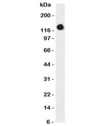 Western blot testing of CD50 / ICAM3 antibody and HL60 cell lysate (clone CDLA50-1). Observed molecular weight: 60~120 kDa depending on glycosylation level.