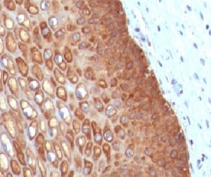 Immunohistochemistry of Keratin 14 / KRT14 in human cervix tissue. Formalin-fixed, paraffin-embedded human cervix tissue stained with Keratin 14/KRT14 antibody (clone CTKN14-1) shows strong cytoplasmic staining in basal and parabasal squamous epithelial cells, with reduced staining in more superficial differentiated layers and minimal signal in adjacent stromal tissue. Antigen retrieval was performed by boiling tissue sections in 10 mM Tris with 1 mM EDTA, pH 9.0, for 10-20 minutes, followed by cooling at room temperature for 20 minutes.