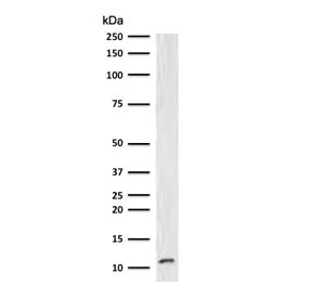 Western blot testing of human Raji cell lysate with B2M antibody (clone MGBP2-1).