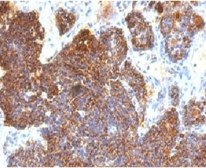 Parathyroid Hormone Antibody C Terminus immunohistochemistry of human parathyroid gland. FFPE human parathyroid tissue stained with Parathyroid Hormone Antibody C Terminus clone PRTM1-3, a mouse monoclonal antibody recognizing the C-terminal region of Parathyroid hormone (PTH). Strong cytoplasmic brown chromogenic staining is observed in parathyroid endocrine chief cells, consistent with the expected intracellular localization of Parathyroid hormone within hormone-producing cells of the parathyroid gland. Immunohistochemistry staining was performed following heat-induced epitope retrieval by boiling tissue sections in pH 9 10mM Tris with 1mM EDTA for 10-20 minutes, followed by cooling at room temperature for 20 minutes prior to staining.
