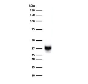 PMEL17 Antibody for WB (clone MSSG95). Western blot analysis of human COLO-38 melanoma cell lysate using PMEL17 Antibody for WB clone MSSG95. Lane 1: human COLO-38 cell lysate. A band is detected at approximately 34-38 kDa, consistent with processed fragments of Premelanosome protein PMEL, also known as gp100. PMEL is synthesized as an approximately 100 kDa glycosylated precursor that undergoes proteolytic cleavage to generate an approximately 60-64 kDa M-alpha fragment and an approximately 26 kDa M-beta fragment. The M-alpha fragment is further processed into approximately 34-38 kDa and approximately 26 kDa fragments that assemble into the fibrillar matrix of developing melanosomes in melanocytic cells.