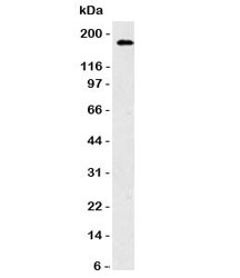 Western blot testing of HCT116 cell lysate and CD56 antibody. Observed molecular weights: 120, 140 and 180 kDa.