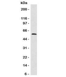 Western blot testing of Fascin antibody and human HeLa cell lysate (clone FAN55-1). Predicted molecular weight ~55 kDa.