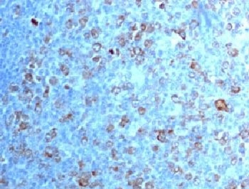 IHC testing of FFPE human tonsil with CDK1 antibody (clone CDVC2-1). Staining of formalin-fixed tissues requires boiling tissue sections in pH 9 10mM Tris with 1mM EDTA for 10-20 min followed by cooling at RT for 20 min.