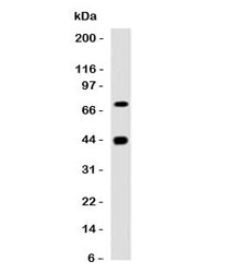 Western blot testing of human skeletal muslce with Muscle Actin antibody (clone PMAC1-1). Predicted molecular weight ~42 kDa.