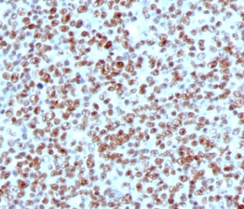 C23/Nucleolin Antibody immunohistochemistry analysis of human tonsil. IHC testing of FFPE human tonsil with C23/Nucleolin Antibody (clone NPC23-2). HRP-DAB brown chromogenic staining highlights nuclei of lymphoid cells within tonsillar tissue, consistent with the nuclear and nucleolar localization of Nucleolin / NCL in proliferating immune cell populations. FFPE testing requires sections to be boiled in pH 9 10mM Tris with 1mM EDTA for 10-20 minutes, followed by cooling at RT for 20 minutes prior to staining.