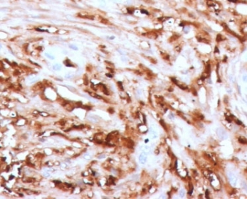 IHC staining of FFPE human pancreas with Ferritin antibody (clone FTLC1-1). HIER: boil tissue sections in pH 9 10mM Tris with 1mM EDTA for 10-20 min and allow to cool before testing.