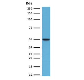 FOXA1 Antibody HeLa Cell WB. Western blot analysis of human HeLa cell lysate using FOXA1 Antibody (clone FHBA1-1) demonstrates a distinct band at approximately 49 kDa, consistent with the predicted molecular weight of FOXA1. FOXA1 is a forkhead family transcription factor and pioneer regulator that facilitates chromatin accessibility and controls developmental gene expression programs involved in organogenesis, epithelial differentiation, and tissue-specific cellular identity. Detection of the expected molecular weight band supports expression of FOXA1 and its role as a developmental transcription factor that coordinates lineage-specific transcriptional networks and differentiated cellular phenotypes.