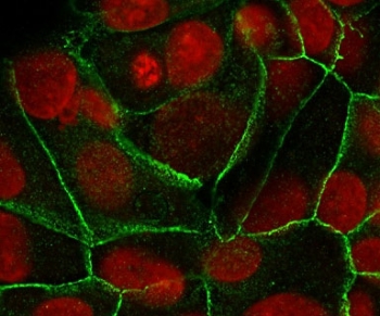 E-cadherin Antibody for IF. Immunofluorescence analysis of Cadherin 1 / CDH1 expression in human MCF7 cells using clone ECD1-2 antibody (green), showing membrane-associated staining with areas of variable continuity at cell-cell junctions, with Reddot nuclear stain (red). Signal highlights junctional organization and localized changes in cell-cell adhesion consistent with junction remodeling.
