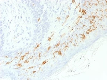CD1A Antibody for IHC. Immunohistochemistry analysis of CD1A / CD1a expression in FFPE human skin using CD1A Antibody. Membranous and cytoplasmic staining is observed in dendritic cells within the epidermis, consistent with Langerhans cell localization, while surrounding keratinocytes remain largely negative. The staining pattern highlights antigen-presenting cells positioned for lipid antigen capture and presentation at the epithelial surface, supporting investigation of CD1a-mediated immune activation in skin. Required HIER: boil tissue sections in 10 mM citrate buffer, pH 6, for 10-20 minutes.