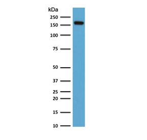 Western blot testing of human HeLa cell lysate with Topoisomerase II alpha antibody (clone TPM2A-2). Expected molecular weight ~174 kDa.