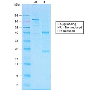 SDS-PAGE analysis of purified, BSA-free recombinant CD20 antibody (clone IGEL/1497R) as confirmation of integrity and purity.