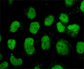 TOP2A Antibody / DNA Replication Enzyme Antibody (clone TPM2A-1). Immunofluorescence analysis of PFA-fixed human HeLa cells demonstrates strong nuclear staining of DNA Topoisomerase II alpha, a DNA replication enzyme required for resolving torsional stress generated during DNA synthesis. Green fluorescence highlights nuclear localization of TOP2A in proliferating cells where active DNA replication and replication fork progression are occurring. As a DNA Replication Enzyme Antibody, clone TPM2A-1 enables visualization of the nuclear enzyme responsible for maintaining DNA topology during genome duplication, supporting studies of replication dynamics and DNA synthesis in dividing cells.