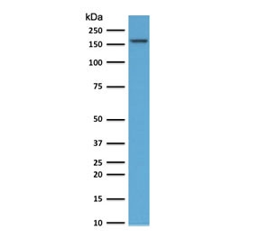 TOP2A Antibody / DNA Replication Enzyme Antibody (clone TPM2A-1). Western blot analysis of human HeLa cell lysate following SDS-PAGE separation and membrane transfer demonstrates detection of DNA Topoisomerase II alpha. A band is detected at approximately 170-180 kDa, consistent with the predicted molecular weight of DNA Topoisomerase II alpha / TOP2A (~174 kDa). The detected band corresponds to the DNA replication enzyme responsible for resolving topological stress generated during DNA synthesis and replication fork progression. Detection of the denatured TOP2A protein band supports the use of this DNA Replication Enzyme Antibody for western blot analysis of DNA Topoisomerase II alpha in human cell lysates.