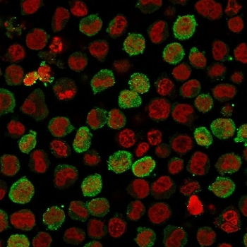 Calponin Antibody K562 IF. Immunofluorescence analysis of PFA-fixed human K562 cells using Calponin antibody (green). The recombinant rabbit monoclonal antibody clone CNN1/1408R shows cytoplasmic staining consistent with Calponin 1 / CNN1 localization, highlighting actin-associated cytoskeletal structures. Nuclei are counterstained with Reddot (red), and the merged signal supports intracellular distribution of this actin-binding protein in immunofluorescence applications.