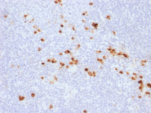Human IgG Antibody IG507R Human Tonsil IHC. Immunohistochemistry was performed on FFPE human tonsil tissue using Human IgG Antibody IG507R. Heat-induced epitope retrieval was performed by steaming tissue sections in 10 mM citrate buffer (pH 6.0) for 10-20 minutes prior to staining. Strong cytoplasmic staining is observed in scattered plasma cells throughout the tonsillar lymphoid tissue, while the surrounding lymphocytes exhibit minimal background staining. This staining pattern is consistent with the expected expression of human IgG in antibody-producing plasma cells. These results demonstrate that Human IgG Antibody IG507R is suitable for immunohistochemical detection of human IgG in formalin-fixed, paraffin-embedded human tissues.