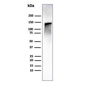 Caldesmon Antibody / CALD1 Cell Motility and Migration Regulatory Protein Antibody. Western blot analysis of Caldesmon (CALD1) in human ovary tissue lysate. Lane 1: human ovary tissue lysate. A band is detected at approximately 120-150 kDa, consistent with the predicted molecular weight of Caldesmon / CALD1 and representing the high molecular weight h-caldesmon isoform associated with contractile cell populations. Additional lower molecular weight bands may be observed at approximately 70-80 kDa corresponding to non-muscle isoforms involved in cytoskeletal remodeling during cell motility and migration. The observed banding pattern reflects isoform-dependent expression of CALD1 linked to dynamic cytoskeletal regulation and cellular movement.