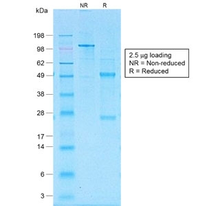 SDS-PAGE analysis of purified, BSA-free recombinant CD30 antibody (clone Ki-1/1505R) as confirmation of integrity and purity.