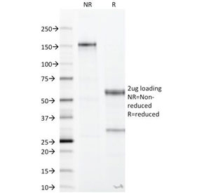 SDS-PAGE Analysis of Purified, BSA-Free Recombinant CA19-9 Antibody Rabbit Monoclonal (clone CA19.9/1390R). Confirmation of Integrity and Purity of the Antibody.