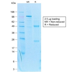 SDS-PAGE analysis of purified, BSA-free recombinant Cytokeratin 7 antibody (clone KRT7/1499R) as confirmation of integrity and purity.