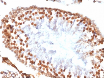IHC testing of FFPE rat testis tissue with recombinant WT1 antibody (clone WT1/1434R). HIER: steam sections in pH 9 10mM Tris with 1mM EDTA for 10-20 min.