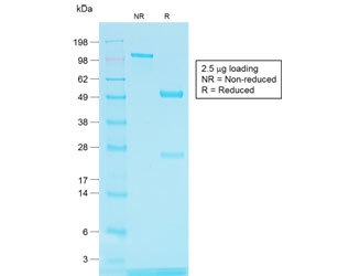SDS-PAGE analysis of purified, BSA-free recombinant TYRP1 antibody (clone TYRP1/1564R) as confirmation of integrity and purity.