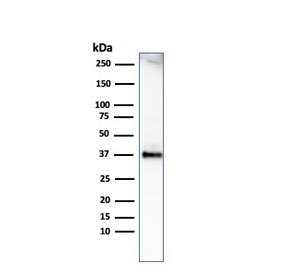 Western blot testing of human heart lysate with recombinant Histone H1 (clone HH1/1784R). Observed molecular weight ~22/30-33 kDa (unmodified/modified).