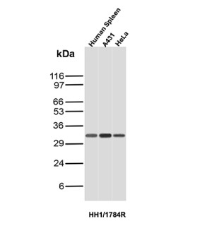 Histone H1 Antibody HH1/1784R in Human Spleen, A431 and HeLa WB. Western blot testing of clone HH1/1784R in human spleen tissue, A431 epidermoid carcinoma cell and HeLa cervical cancer cell lysates. A strong, discrete band is observed at approximately 32-33 kDa in all three samples, consistent with detection of linker histone H1. This Histone H1 Antibody supports studies of linker histone function in higher-order chromatin fiber formation and nuclear organization.