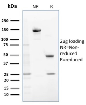 GST Mu 1 Antibody Purity Analysis by SDS-PAGE. Electrophoretic analysis of purified GST Mu 1 Antibody / Mu Class GST Antibody under non-reducing (NR) and reducing (R) conditions with 2 ug of antibody loaded per lane. The non-reduced antibody migrates predominantly at approximately 150 kDa, consistent with intact IgG, while reduction produces bands at approximately 50 kDa and 25 kDa, corresponding to the IgG heavy and light chains, respectively. This analysis confirms the purity and structural integrity of the purified GST Mu 1 Antibody.