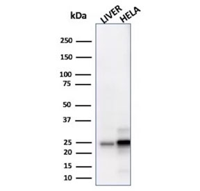 Western blot testing of human liver and HeLa cell lysate with GSTM3 antibody. Predicted molecular weight ~26 kDa.
