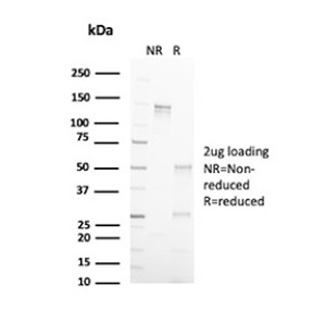 Annexin A1 Antibody CPTC-ANXA1-1 Purity SDS-PAGE. SDS-PAGE analysis of purified Annexin A1 Antibody, clone CPTC-ANXA1-1, was performed under non-reducing (NR) and reducing (R) conditions with 2 ug of antibody loaded per lane. The non-reduced sample shows the intact antibody, while reduction produces bands corresponding to the immunoglobulin heavy and light chains at approximately 50 and 25 kDa, respectively. This analysis confirms the purity and structural integrity of the mouse monoclonal ANXA1 antibody preparation.