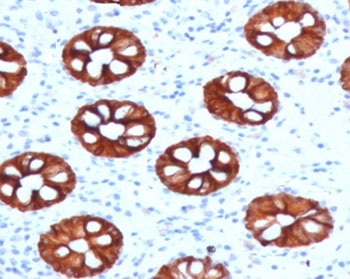 KRT20 Antibody Mouse Monoclonal CTKN20-1. Immunohistochemistry analysis of human colon tissue using mouse monoclonal KRT20 antibody (clone CTKN20-1). HRP-DAB brown chromogenic staining highlights cytoplasmic Keratin 20 / Cytokeratin 20 (KRT20) expression in epithelial cells lining colonic glandular crypt structures, while surrounding stromal cells remain largely negative. The staining pattern reflects the expected epithelial localization of this intermediate filament protein in gastrointestinal mucosa. Required HIER: boil tissue sections in 10 mM citrate buffer, pH 6, for 10-20 min followed by cooling at RT for 20 min.
