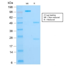 SDS-PAGE analysis of purified, BSA-free recombinant Cytokeratin 16 antibody (clone rKRT16/1714) as confirmation of integrity and purity.