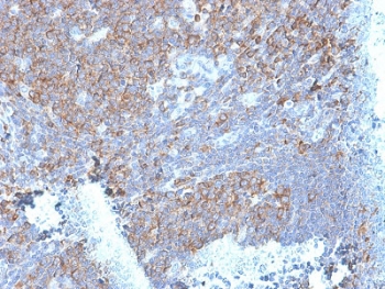 IHC testing of FFPE human tonsil stained with RPSA antibody (clone RPSA/2699). Required HIER: boiling tissue sections in pH 9 10mM Tris with 1mM EDTA for 10-20 min followed by cooling at RT for 20 min.