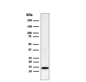 LGALS1 Antibody HeLa WB. Western blot analysis of human HeLa cell lysate using recombinant LGALS1 antibody (clone GAL1/2499R). A strong, distinct immunoreactive band is detected at approximately 14 kDa, corresponding to the expected molecular weight of LGALS1, also known as Galectin-1. LGALS1 is a beta-galactoside-binding lectin that regulates cell adhesion, immune homeostasis, apoptosis, angiogenesis, and glycan-mediated signaling pathways. The clean single-band staining pattern supports the specificity of recombinant clone GAL1/2499R for detection of endogenous LGALS1 protein by western blot. Predicted molecular weight: ~14 kDa.